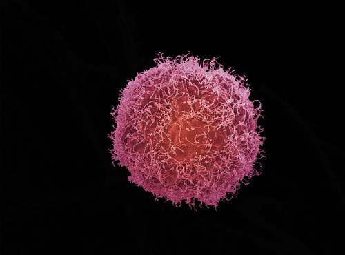 Image of a cancer cell